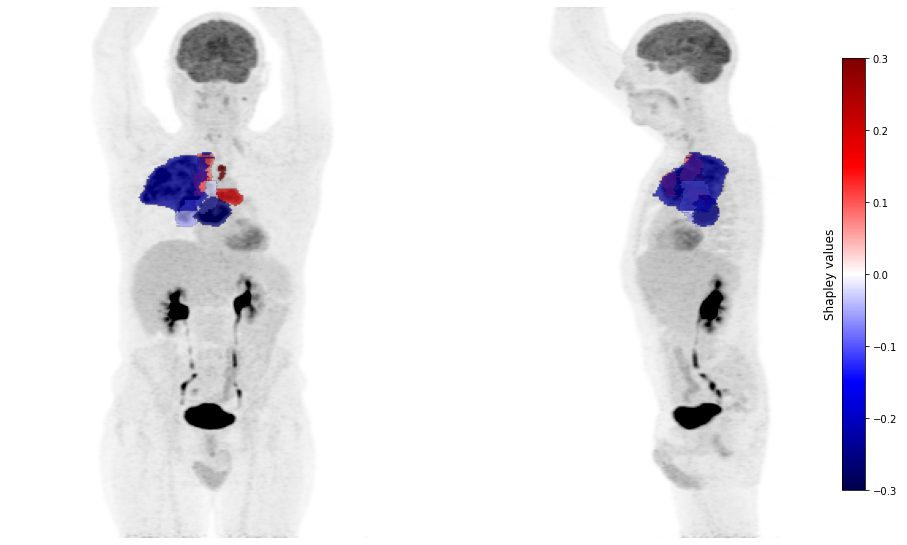 ../_images/_examples_nsclc_subtype_classification_49_0.png